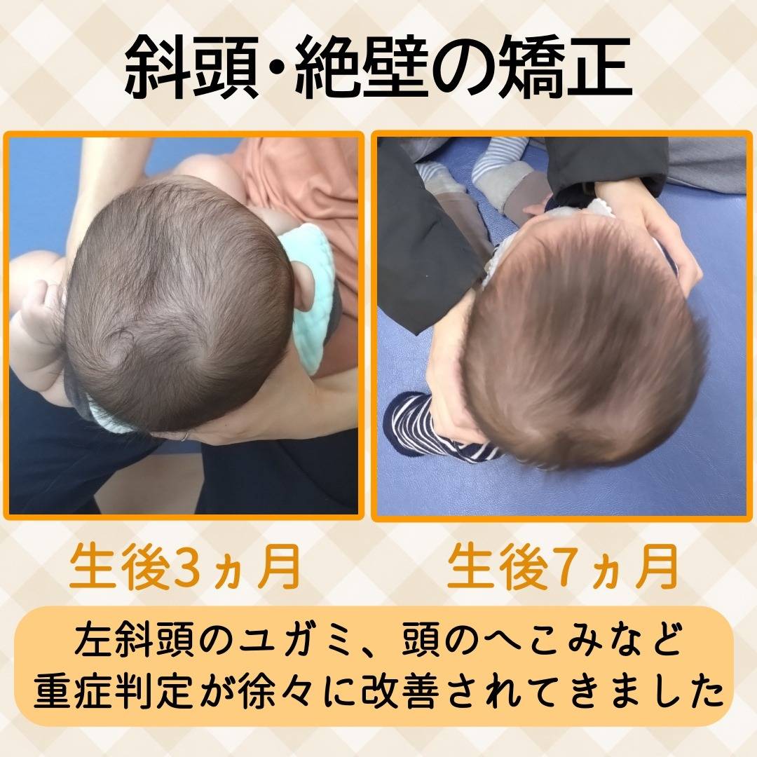 赤ちゃん・小児整体について　大鳥居にある整骨院