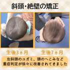 赤ちゃん・小児整体について　大鳥居にある整骨院